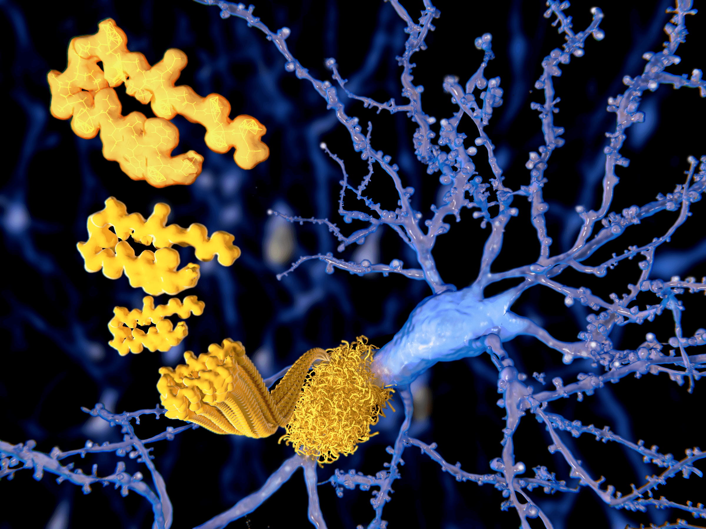 image of amyloid plaque